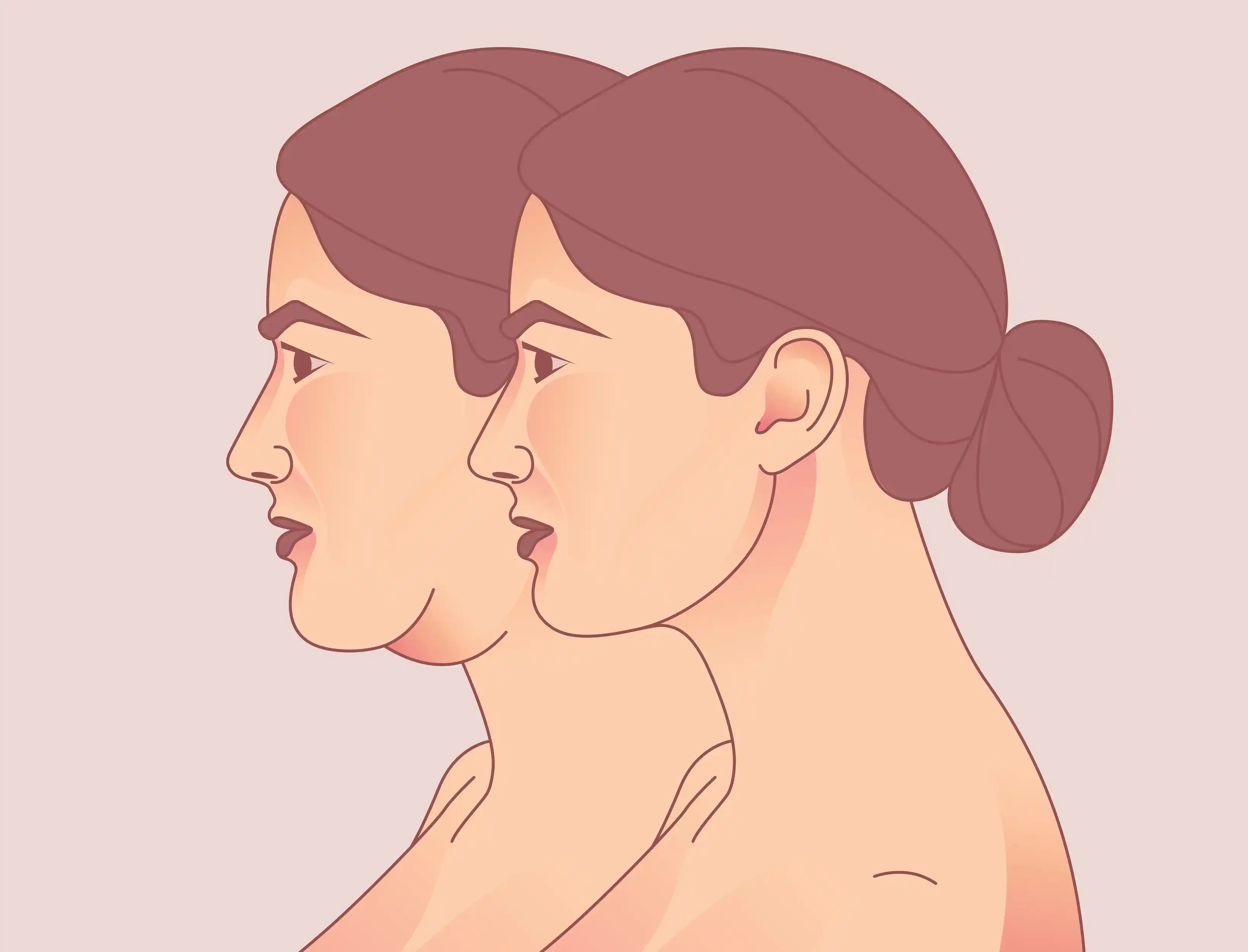 Double-Chin