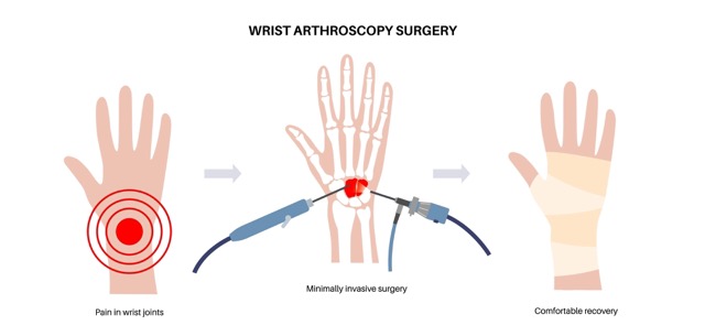 hand-and-wrist