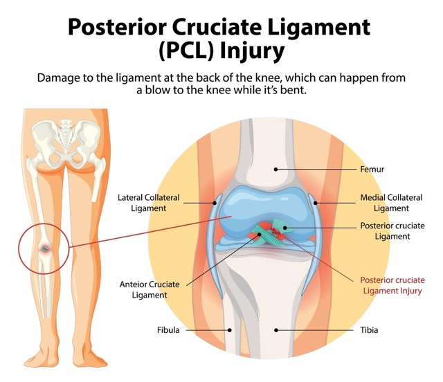 posterior-cruciate-ligament