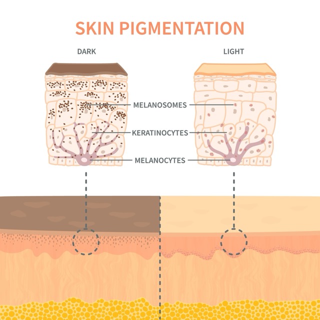 skin-pigmentation