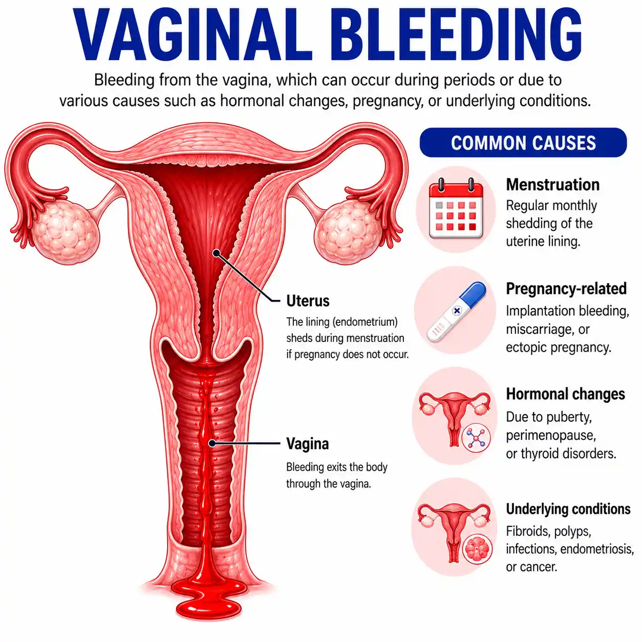 vaginal-bleeding