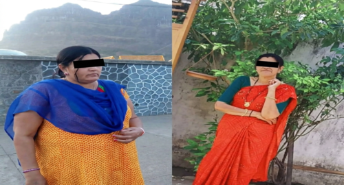 Before and After Images Patient's Underwent Bariatric Surgery - 1 