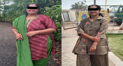 Before and after treatment image 2