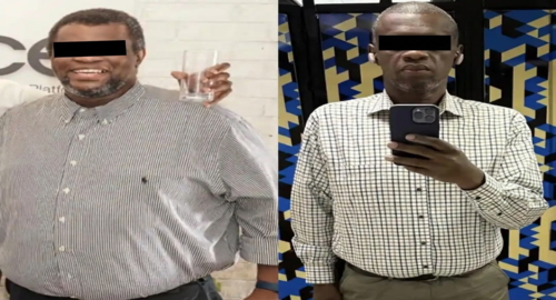 Before and after treatment image 5