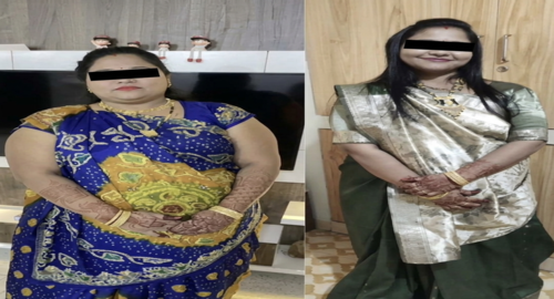 Before and after treatment image 1