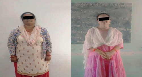 Before and after treatment image 3