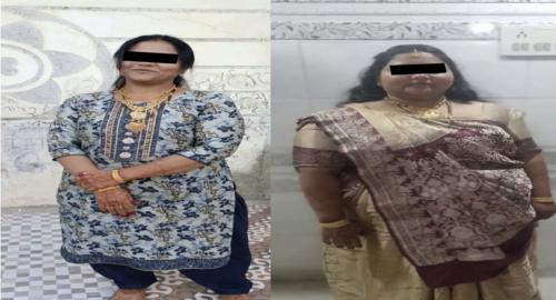 Before and after treatment image 5