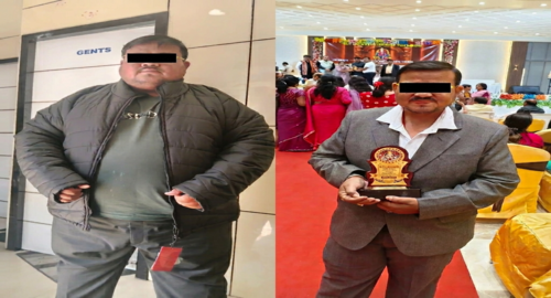 Before and after treatment image 2