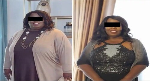 Before and after treatment image 3