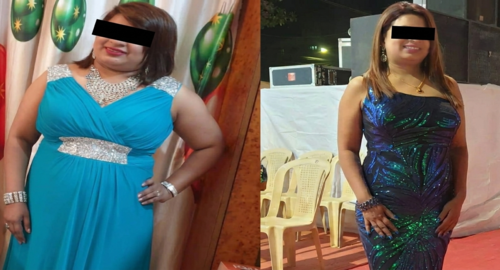 Before and after treatment image 4