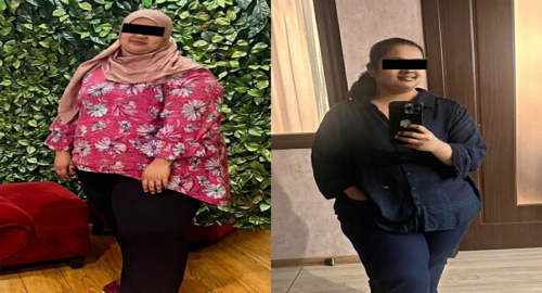 Before and after treatment image 5
