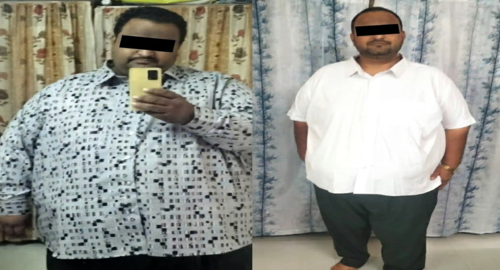 Before and after treatment image 5