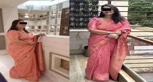 Before and After Image of a Patient Undergone Bariatric Surgery - 2