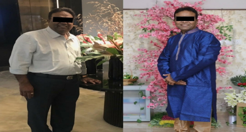 Before and After Images Patient's Underwent Bariatric Surgery - 2