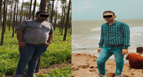 Before and After Images Patient's Underwent Bariatric Surgery - 4
