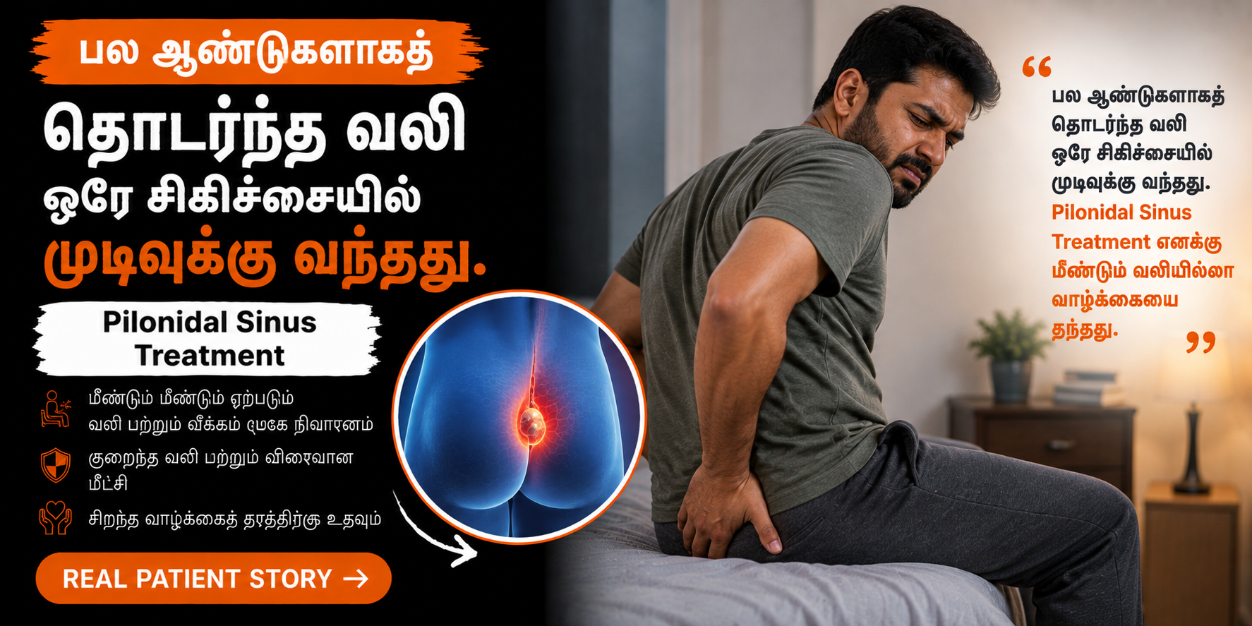Pilonidal-Sinus-Treatment-in-Tamil