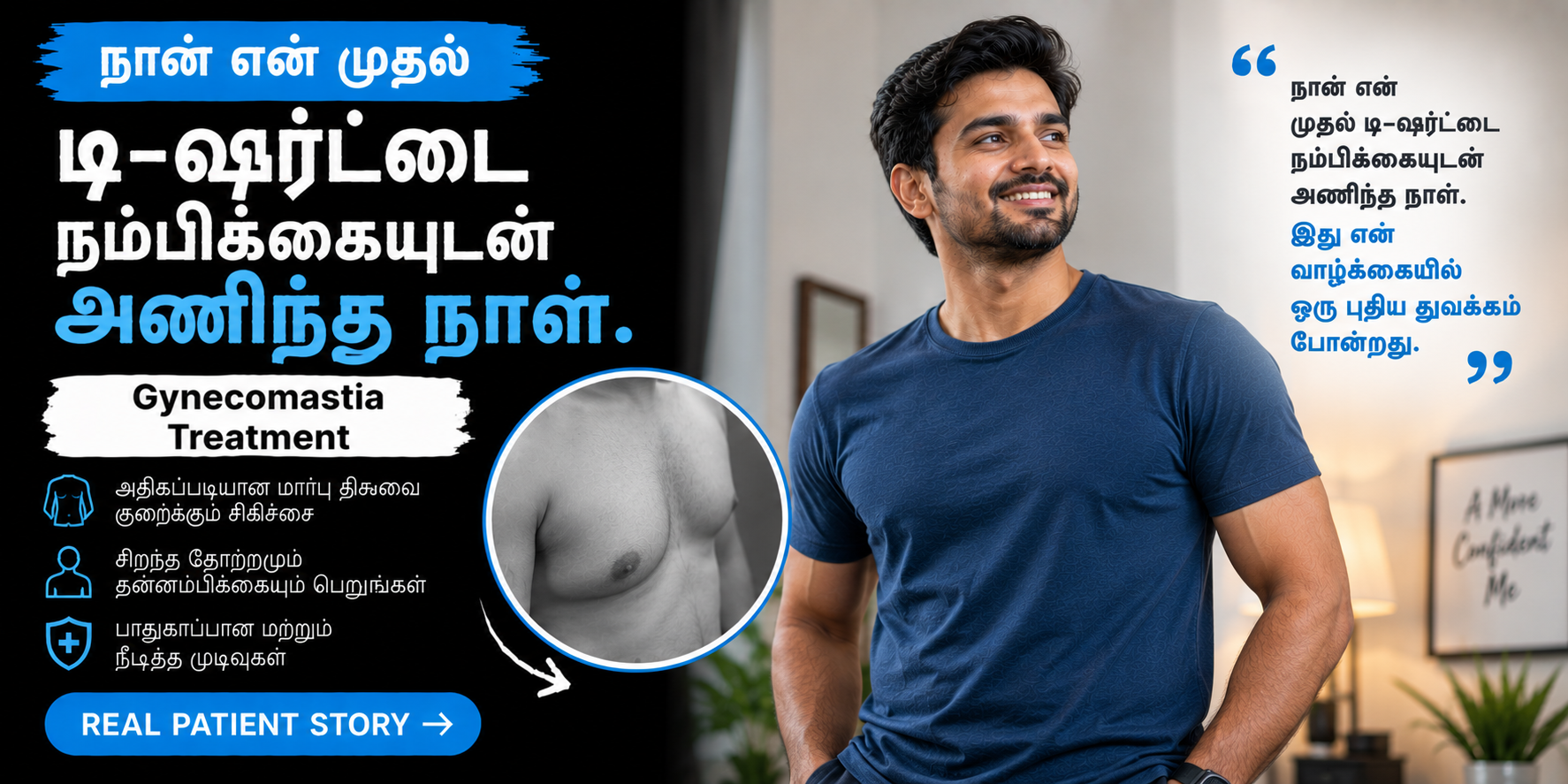 gynaecomastia - patient story in tamil